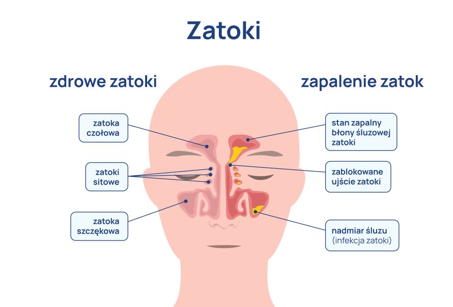 zatoki_infografika