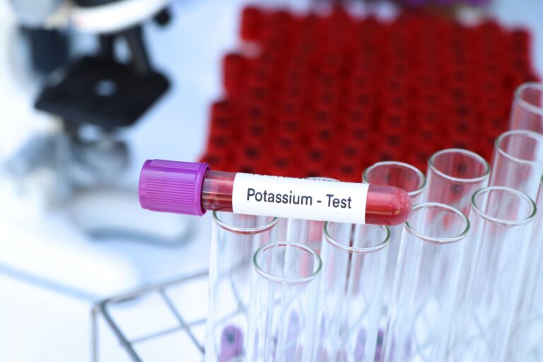 Niedobór potasu (hipokaliemia) – jakie daje objawy? Przyczyny i diagnostyka