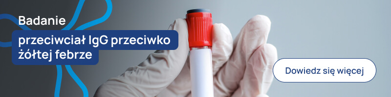Badanie przeciwciał IgG przeciwko żółtej febrze banerek