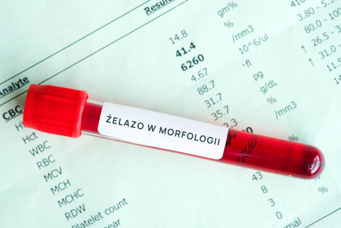 Jak oznaczone jest żelazo w morfologii cover
