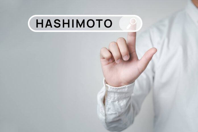 Hashimoto_u_mezczyzn_cover