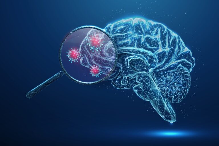Opryszczkowe zapalenie mózgu – czym jest i jak się objawia? Diagnostyka i leczenie