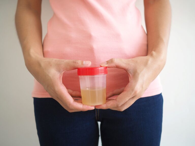 Badanie moczu a okres. Czy miesiączka ma wpływ na badanie moczu?