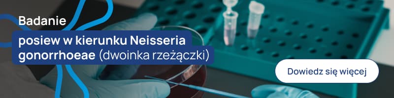 wykrywanie DNA Neisseria gonorrhoeae (dwoinka rzeżączki) met. RT-PCR-1 banerek