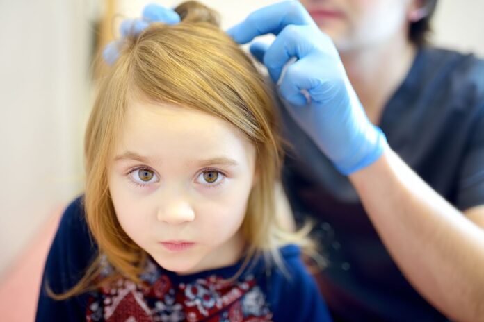 łysienie plackowate u dzieci cover