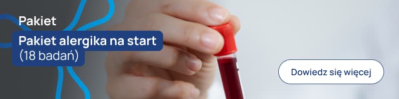 Pakiet alergika na start (18 badań) baner