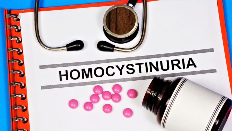 Homocystynuria – co to za choroba i jakie daje objawy? Diagnostyka i leczenie