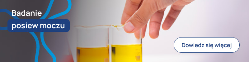 Badanie posiew moczu banerek