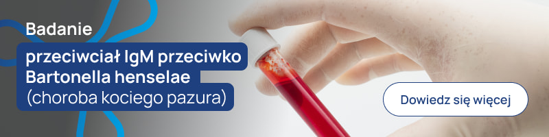 Badanie przeciwciał IgM przeciwko Bartonella henselae (choroba kociego pazura) banerek
