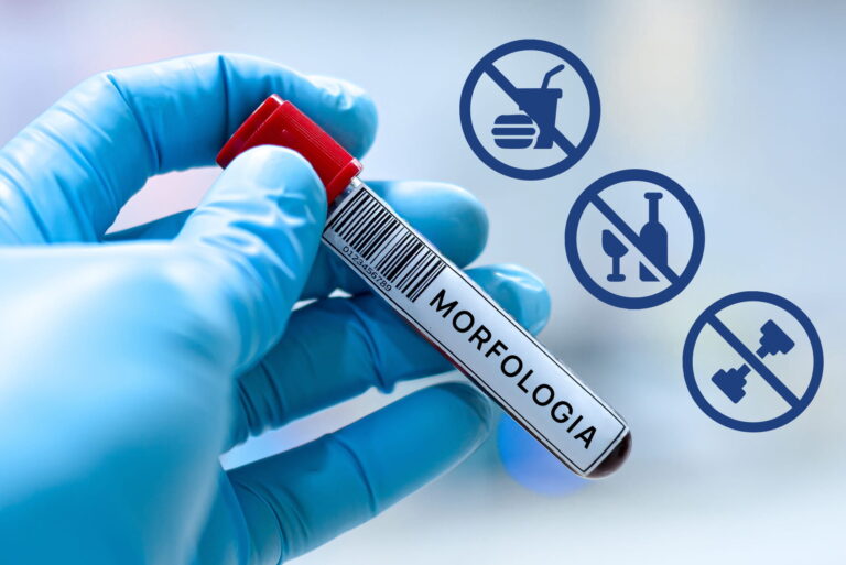 Jak przygotować się do morfologii krwi?