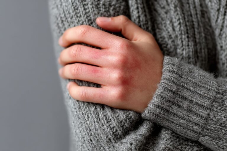 Uczulenie na zimno: jakie są przyczyny i objawy pokrzywki z zimna?