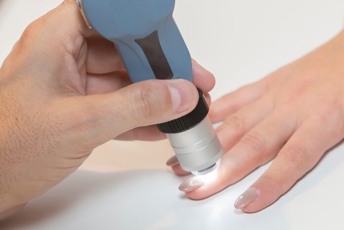 Kapilaroskopia_cover