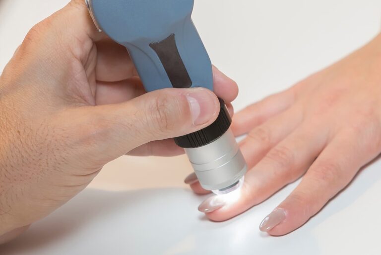 Kapilaroskopia – co to za badanie? Na czym polega i kiedy się je wykonuje?