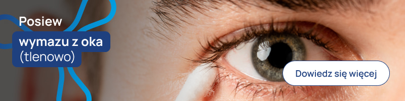 Posiew wymazu z oka (tlenowo) baner