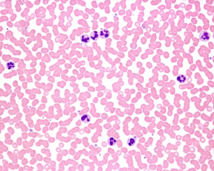 podwyższone leukocyty