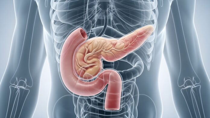 uchyłki dwunastnicy