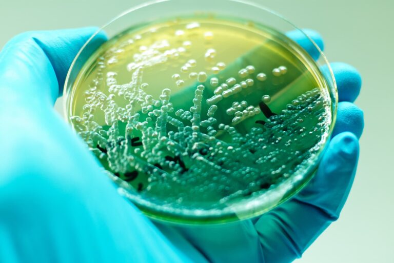 Zielona bakteria na paznokciu – zakażenie Pseudomonas aeruginosa
