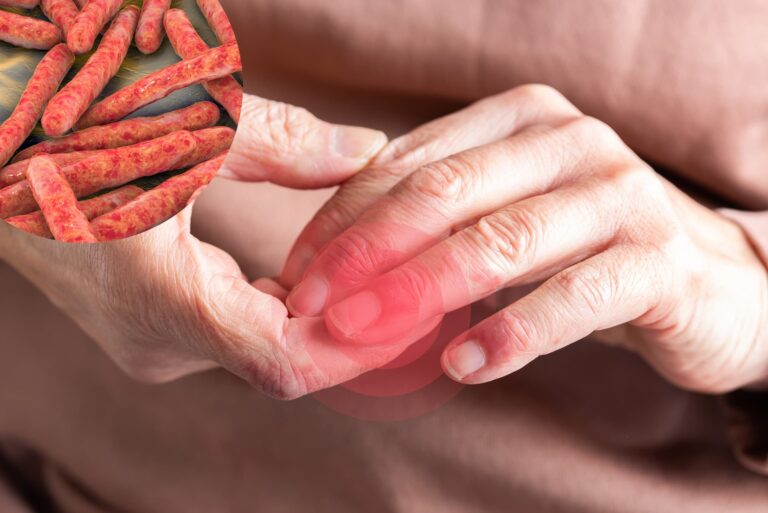 Gruźlica skóry: co to jest i jak się objawia? Przyczyny, diagnostyka i leczenie