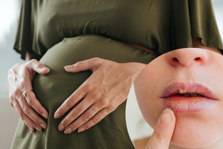 Opryszczka w ciąży – czy jest groźna i jak sobie z nią radzić?