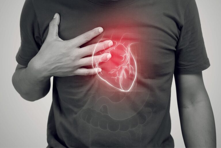 Tamponada serca – objawy, przyczyny i pierwsza pomoc