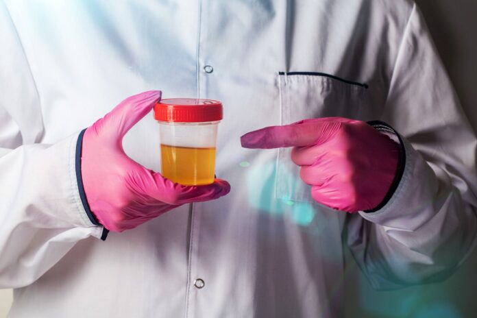 pasma śluzu w moczu