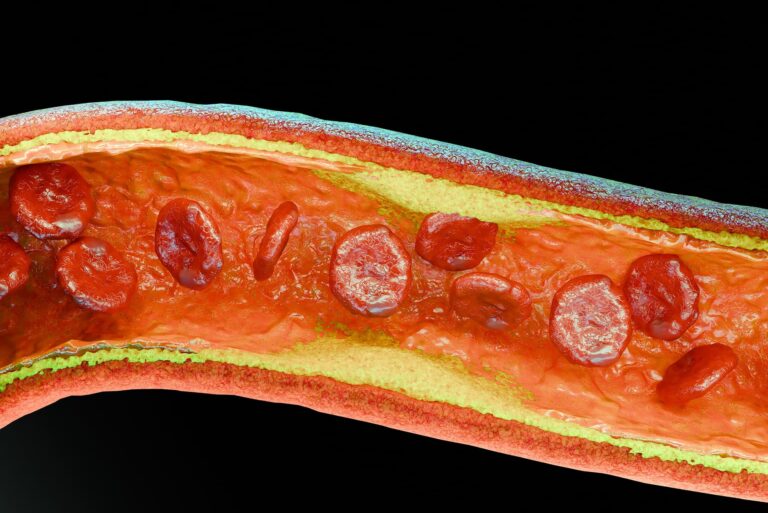 Cholesterol resztkowy – co to jest, jak go obliczyć i jak wpływa na zdrowie?