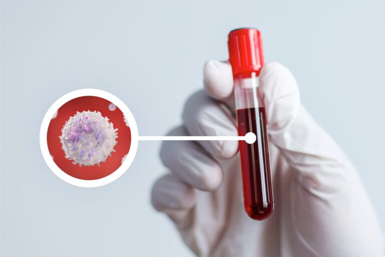 WBC w morfologii – co oznacza i jak interpretować wyniki? O czym świadczy obniżony lub podwyższony poziom?