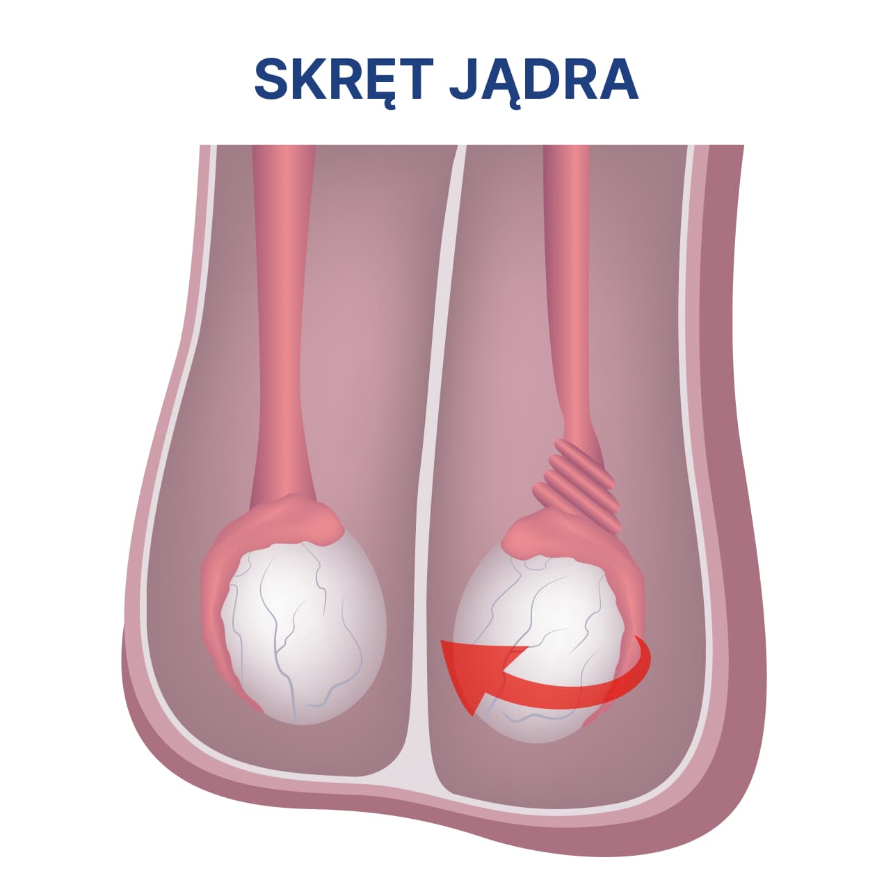 skret_jadra_infografika