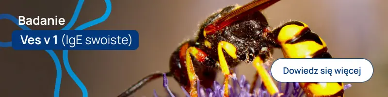 Badanie Ves v 1 (IgE swoiste)
