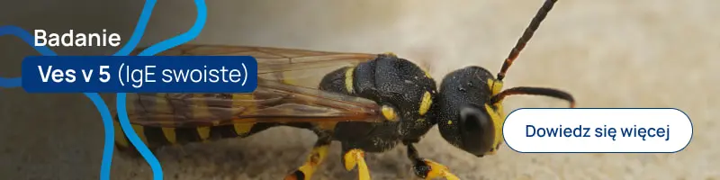 Badanie Ves v 5 (IgE swoiste)