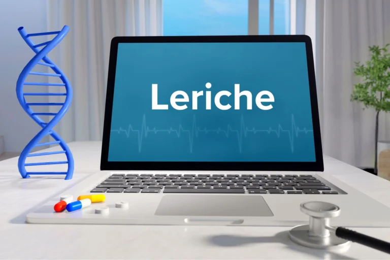 Zespół Leriche’a – przyczyny, objawy, leczenie