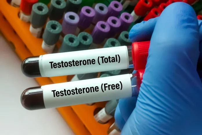 Jak zbadać testosteron cover Jak zbadać testosteron cover